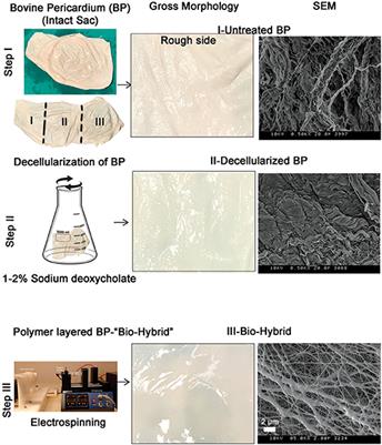 A Biohybrid Material With Extracellular Matrix Core and Polymeric Coating as a Cell Honing Cardiovascular Tissue Substitute